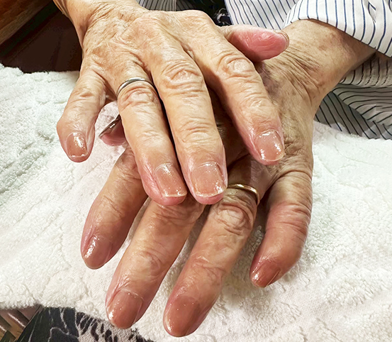 ネイルケア（介護美容）