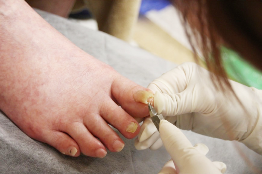 フットケア（足爪ケア）（介護美容）